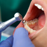 dental-treatment-in-satellite-3.jpg