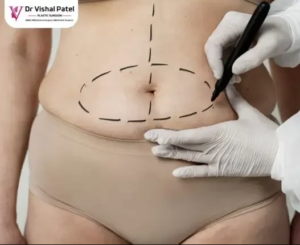 Transform Your Body with a Tummy Tuck in Mumbai