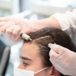 PRP-Hair-Treatment-riyadh-8.jpg