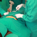 liposuction-facts-questions.jpg